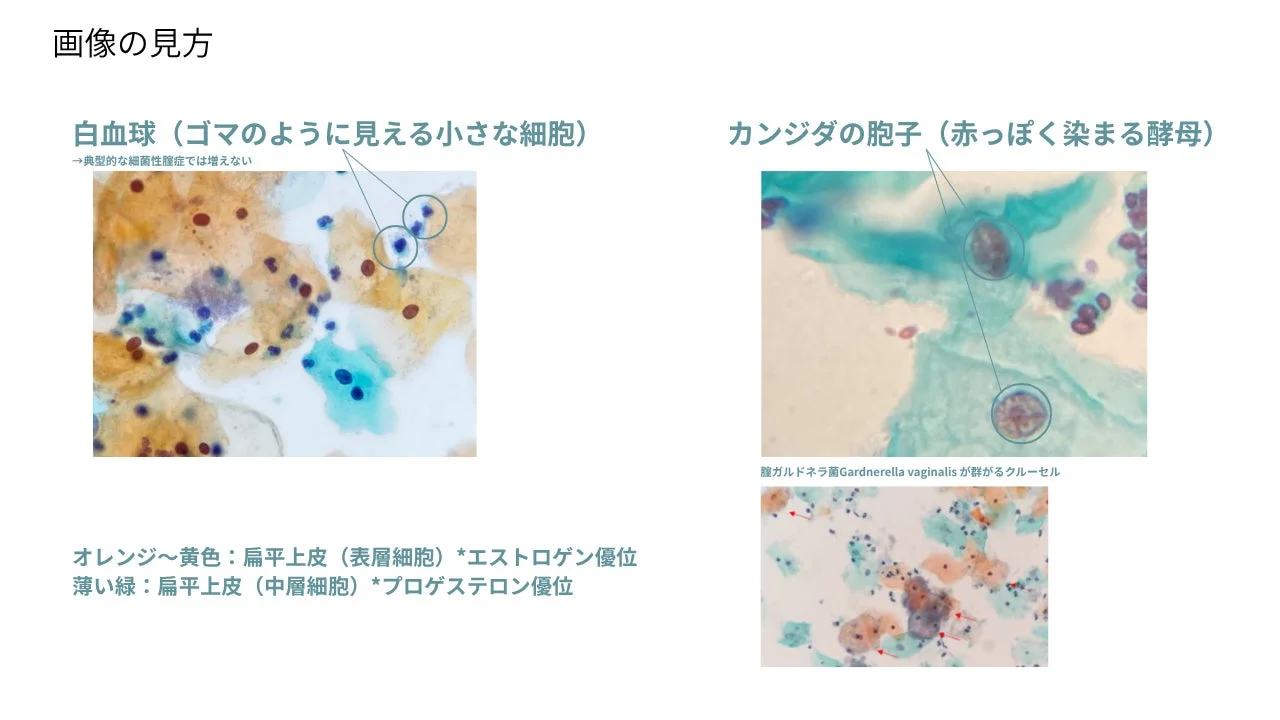 顕微鏡画像の見方解説