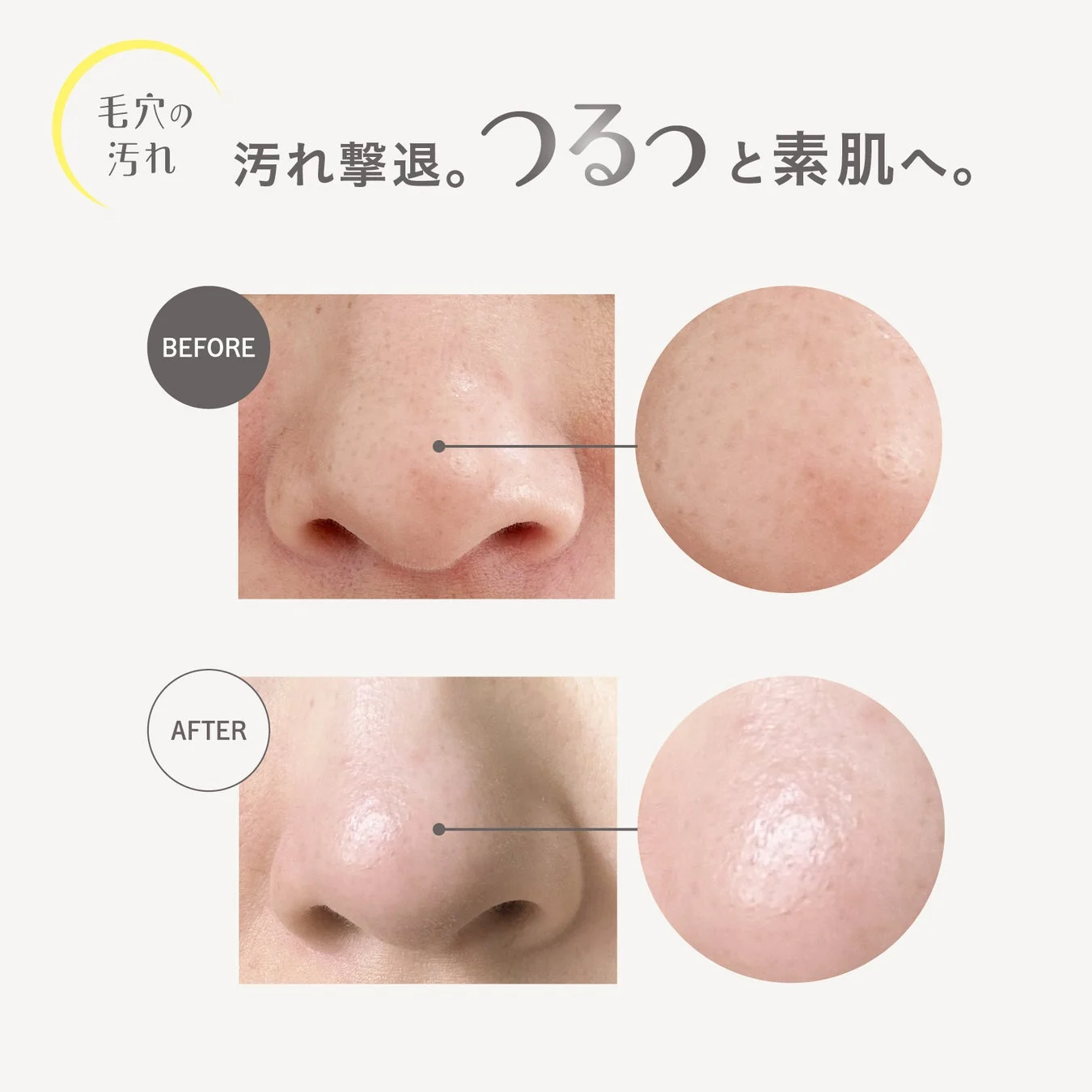 毛穴の汚れビフォーアフター