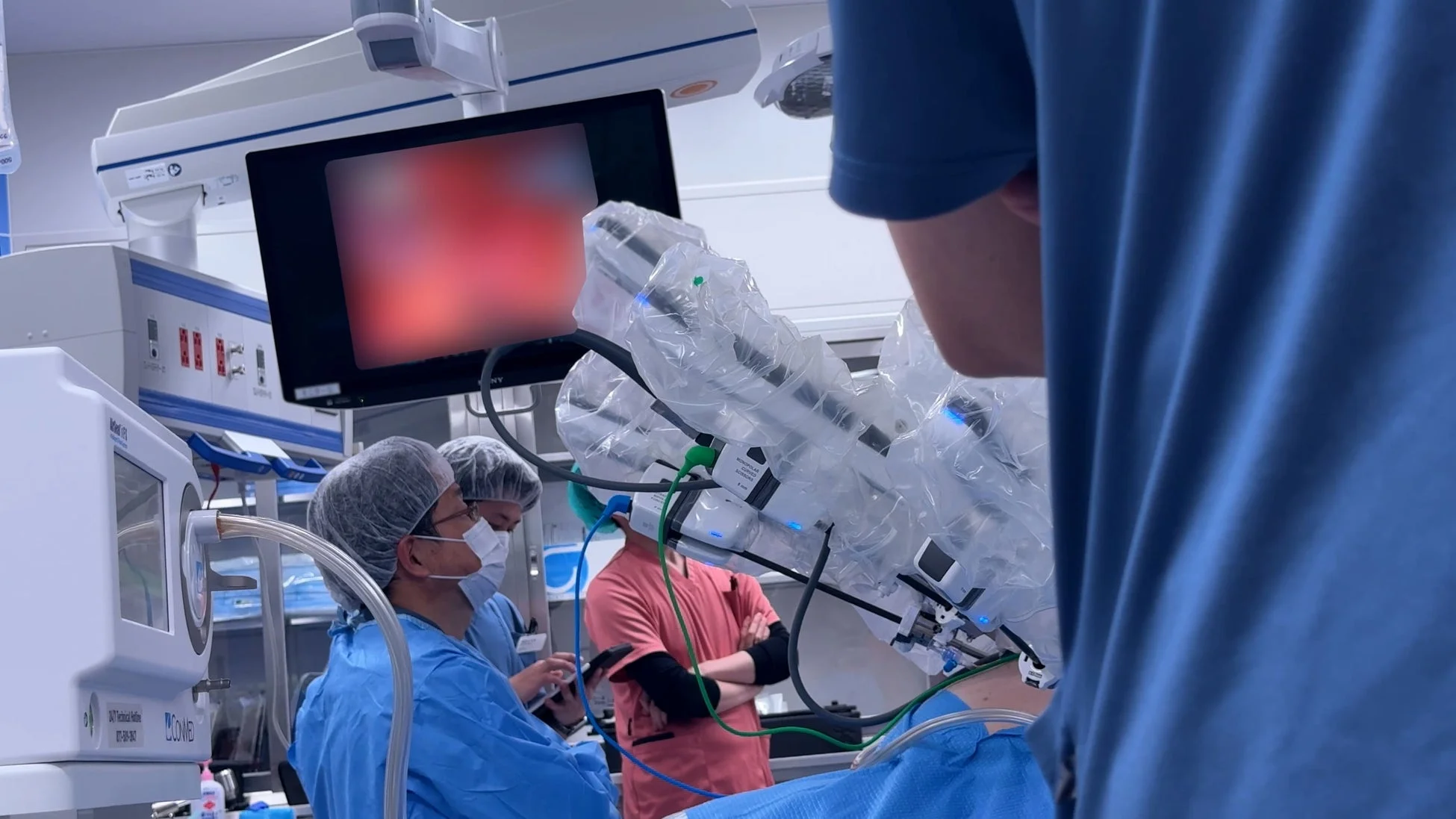 手術室でロボット支援手術が行われている様子、モニターに体内の映像