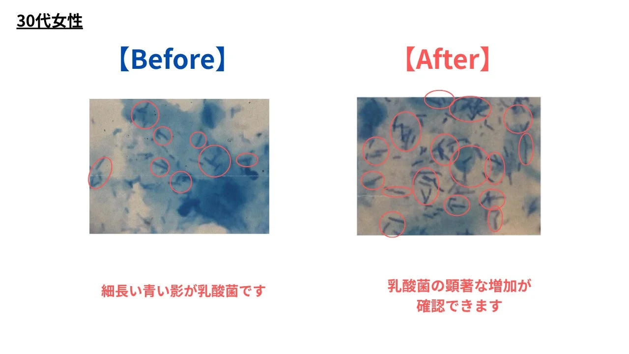 30代女性の乳酸菌増加を示す顕微鏡画像