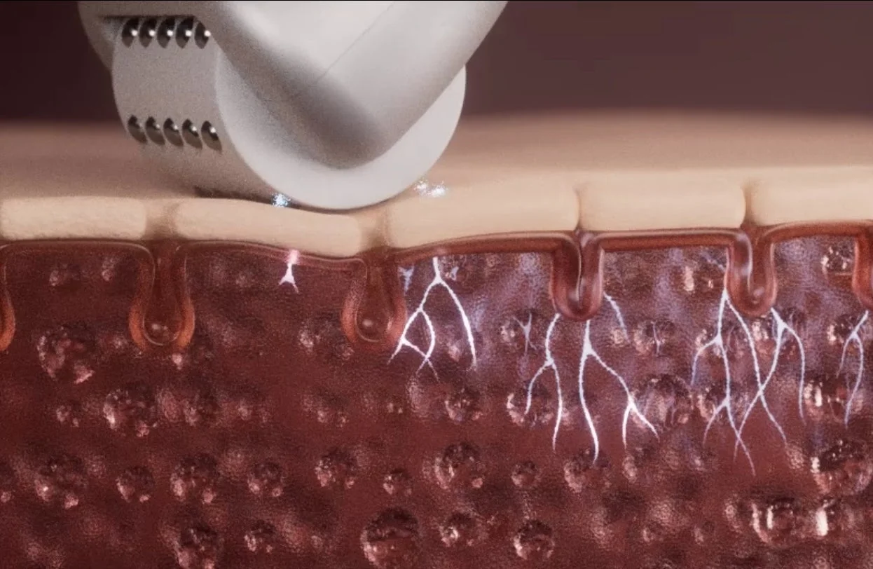 皮膚への作用イメージ