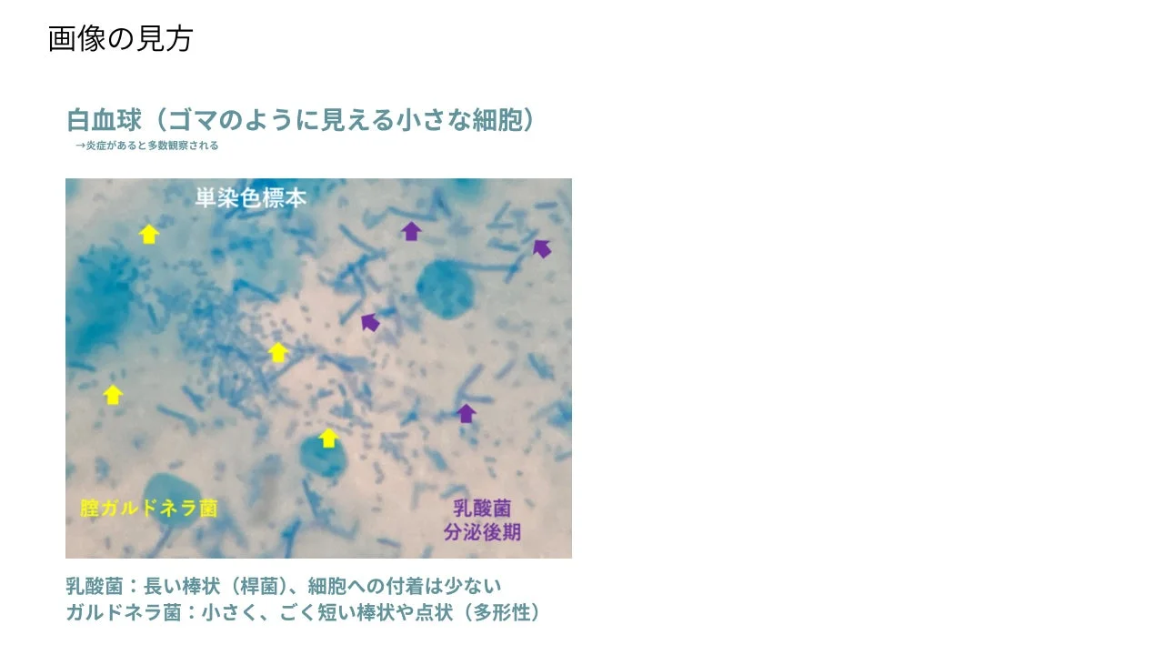 顕微鏡画像の見方解説