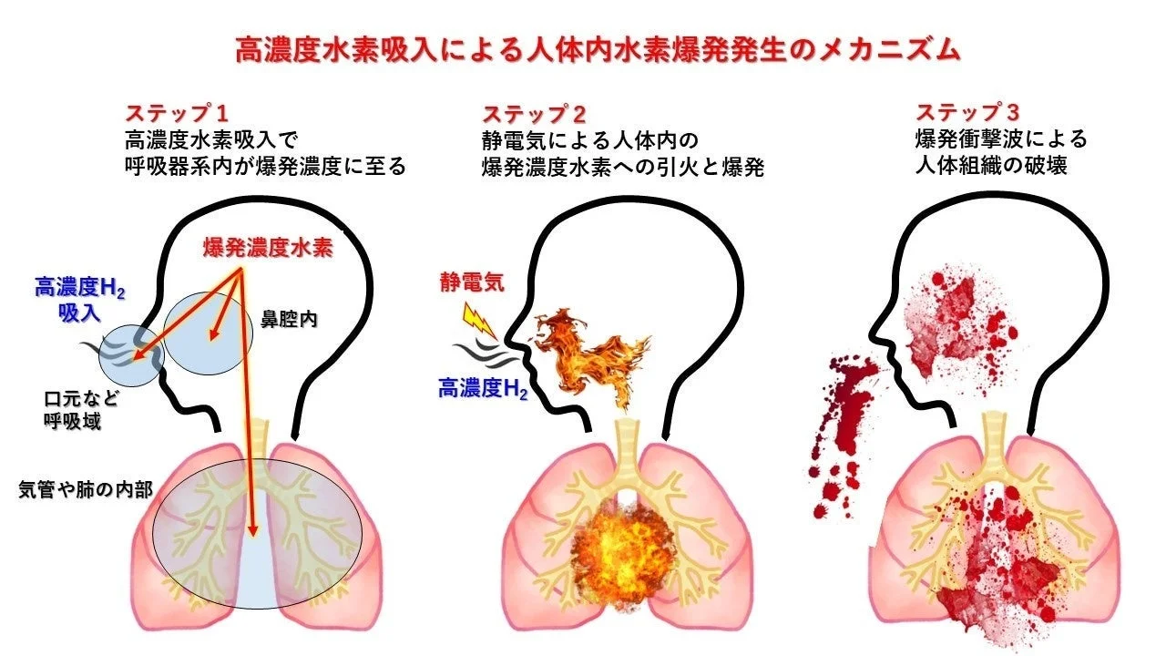 高濃度水素吸入による人体内水素爆発発生のメカニズム