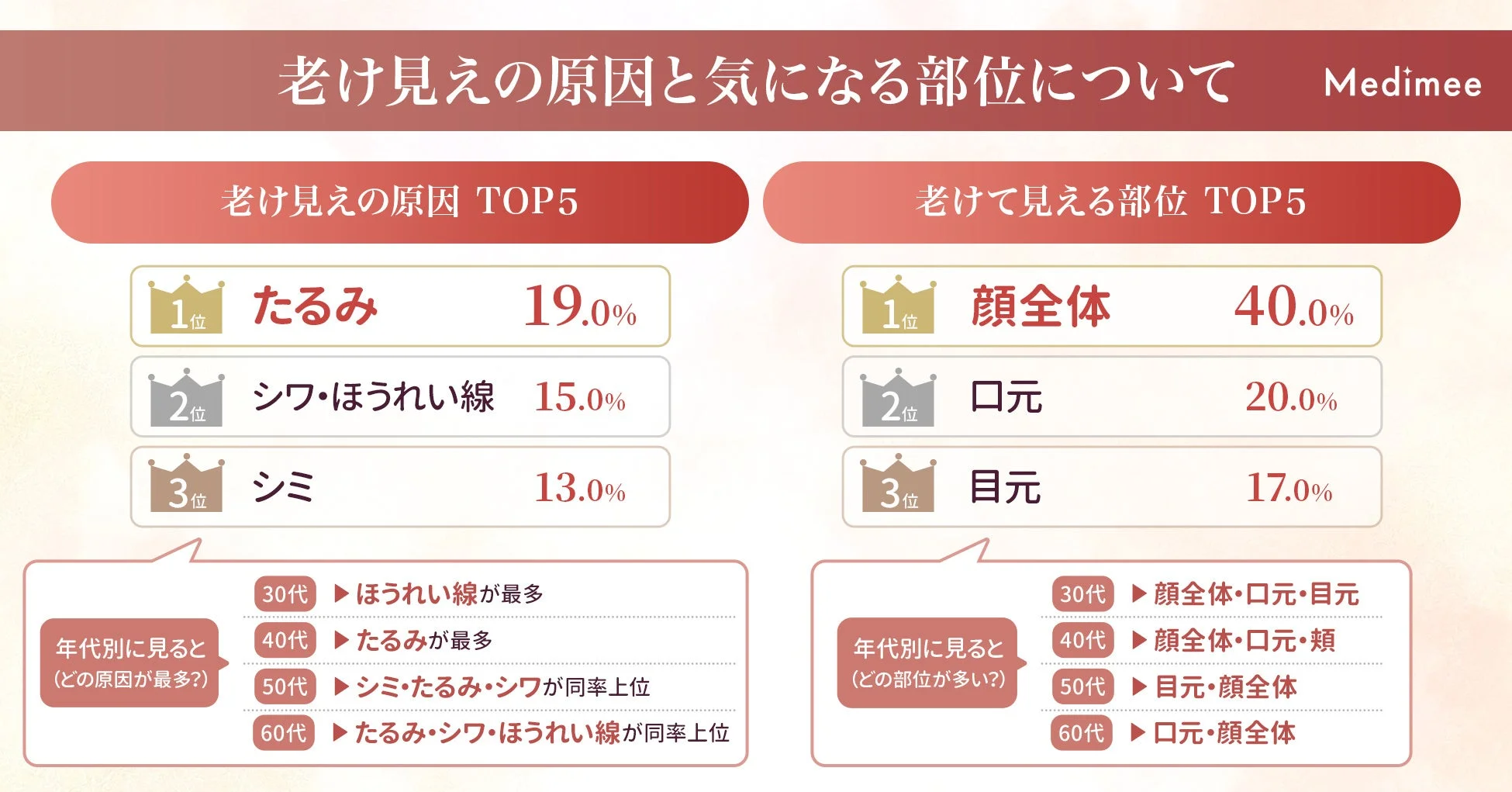 老け見えの原因と気になる部位について